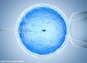 妇科专家